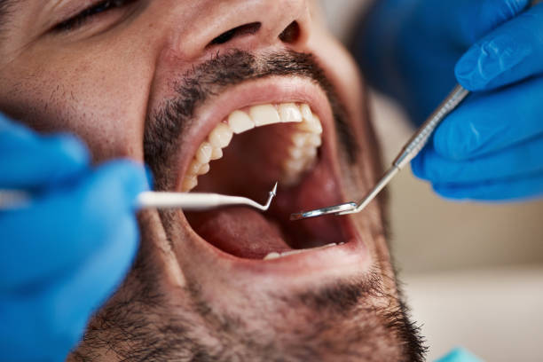 Best Chipped Tooth Repair Near Me  in East Massapequa, NY