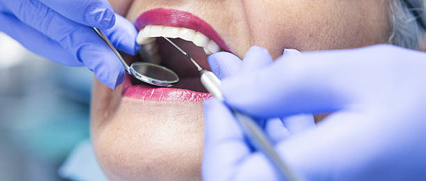 Emergency Dental Filling Replacement in NY