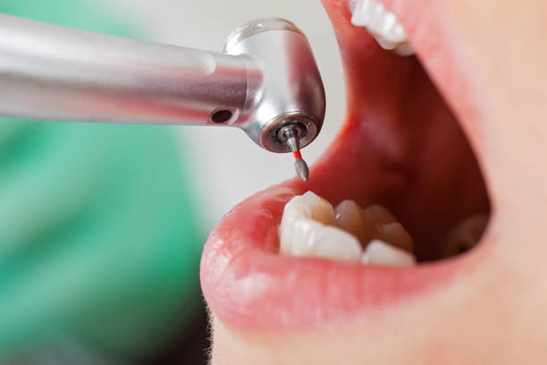 Best Knocked-Out Tooth Emergency  in East Massapequa, NY